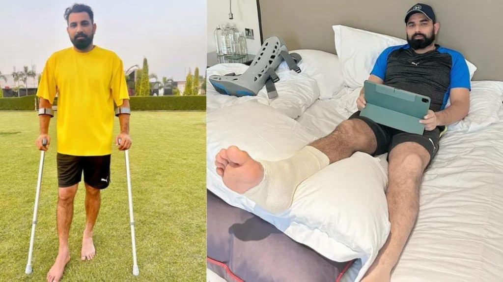 Mohammed Shami may have to go on long rest due to injury.